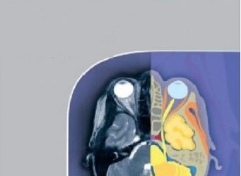 Giải Phẫu Cắt Lớp CT-MRI Tập 1,2,3 pdf