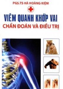 Viêm Quanh Khớp Vai – Chẩn Đoán Và Điều Trị pdf