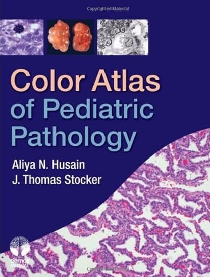 Tải sách: Atlas Giải Phẫu Bệnh Học Nhi Khoa