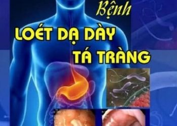 Bệnh Loét Dạ Dày – Tá Tràng pdf