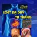 Bệnh Loét Dạ Dày – Tá Tràng pdf
